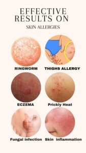 انواع حساسیت پوستی در بدن