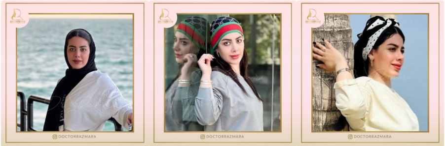 نمونه کارهای بهترین جراح بینی مشهد
