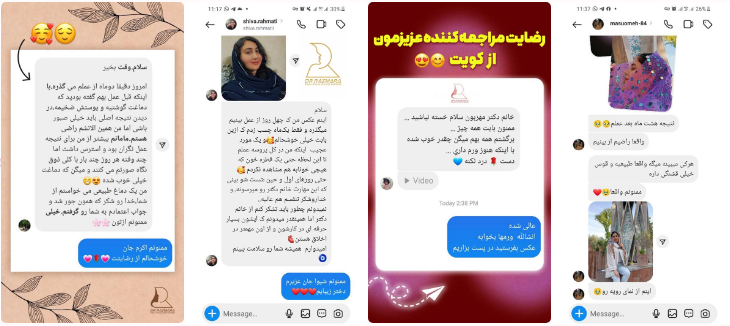 رضایت بیماران از جراح بینی مشهد